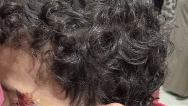 الطالب المجني عليه