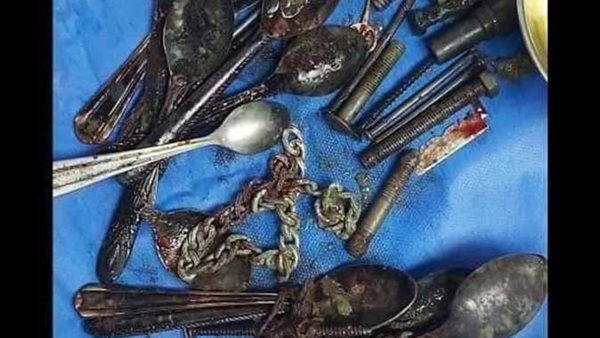 ملاعق ومسامير