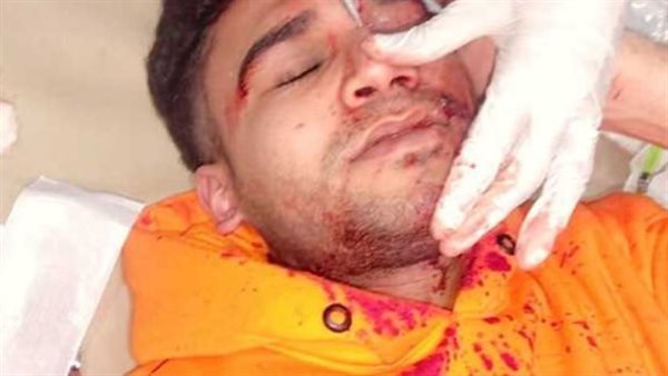 الطالب المصاب بالغردقة