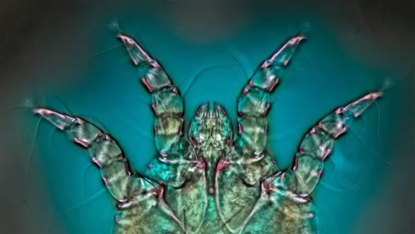 صورة تعبيرية 