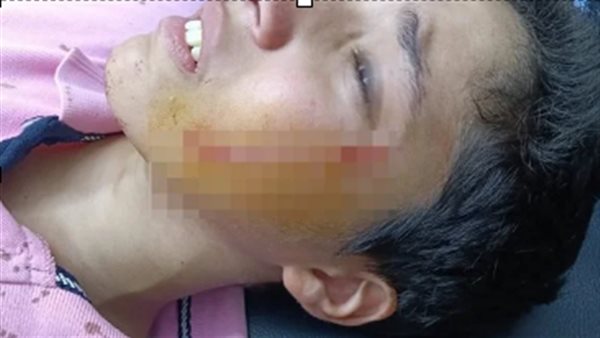 الطالب المجني عليه