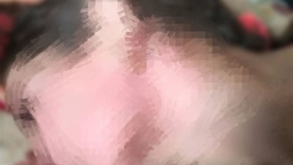 الطفلة سيلا