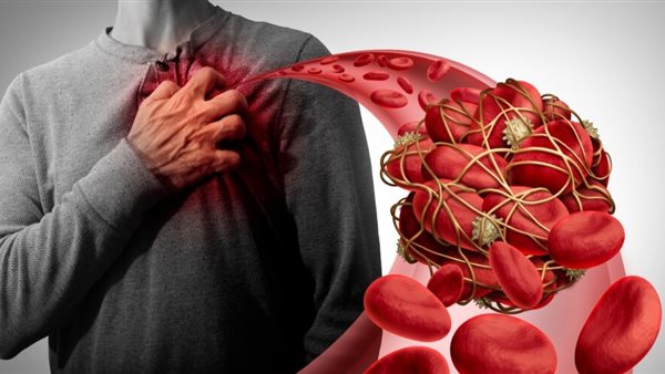 دراسة: الحزن قد يهدد