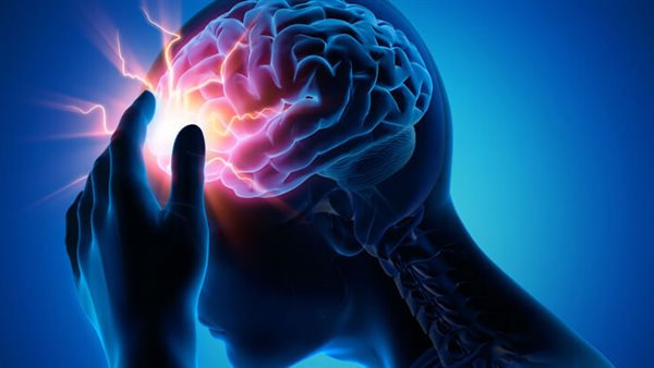 السكتة الدماغية 