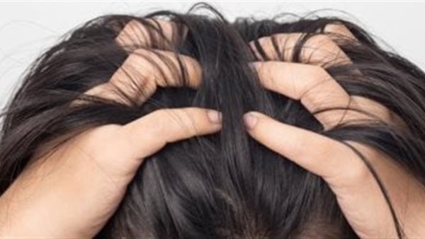 حب الشباب في فروة