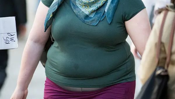 السمنة: ارشيفية 