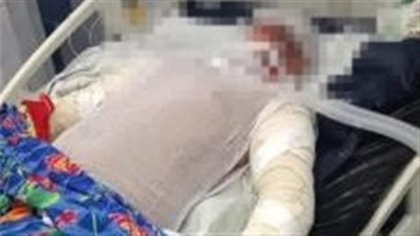 بطل حريق شبرا الخيمة