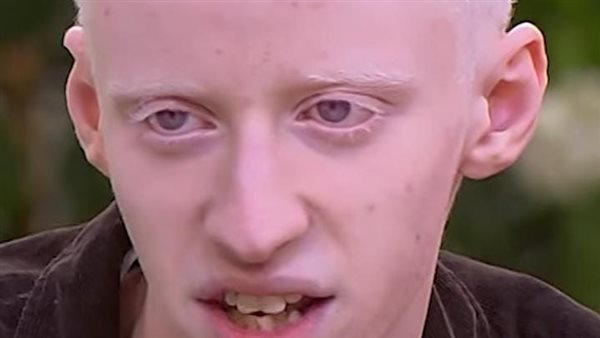 أبطال فيلم ضي في