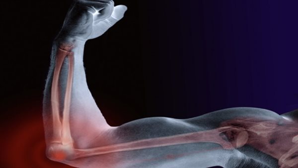  6 أطعمة تقوّي العظام