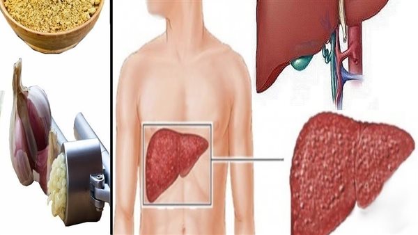 الكبد.. أرشيفية