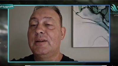 المدير الفني لمنتخب زيمبابوي    