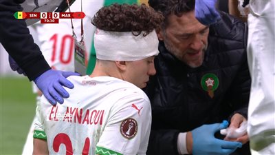 منتخب المغرب.. إصابة قوية لنائل العيناوي لاعب المغرب في رأسه    