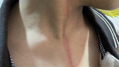 المجني عليه